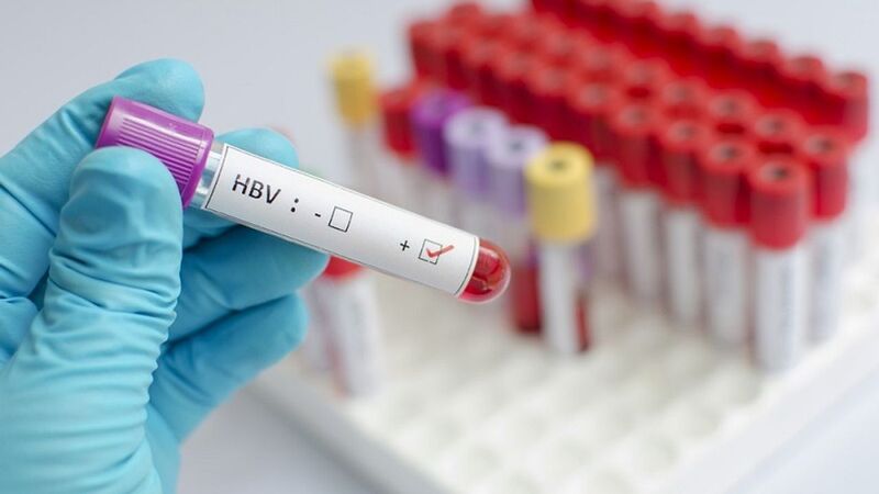 Xét nghiệm HBsAg để kiểm tra xem bạn có bị nhiễm virus viêm gan B hay không