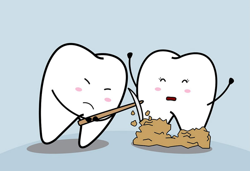 Làm trắng răng là một thủ thuật nha khoa giúp làm sạch mảng bám trên nướu